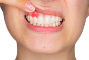 معاینه و چکاپ دندان
