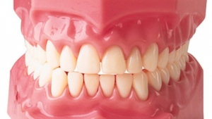 لق شدن دندان ها در بزرگسالی