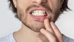 درد ضربان دار دندان