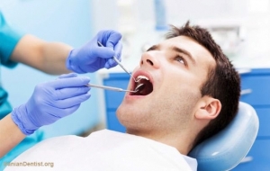 عصب کشی دندان های جلویی