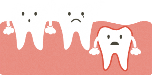 درمان دندانهای نهفته