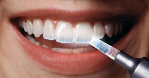 دانستنی های مفید دندانپزشکی