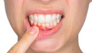 علائم عفونت دندانی